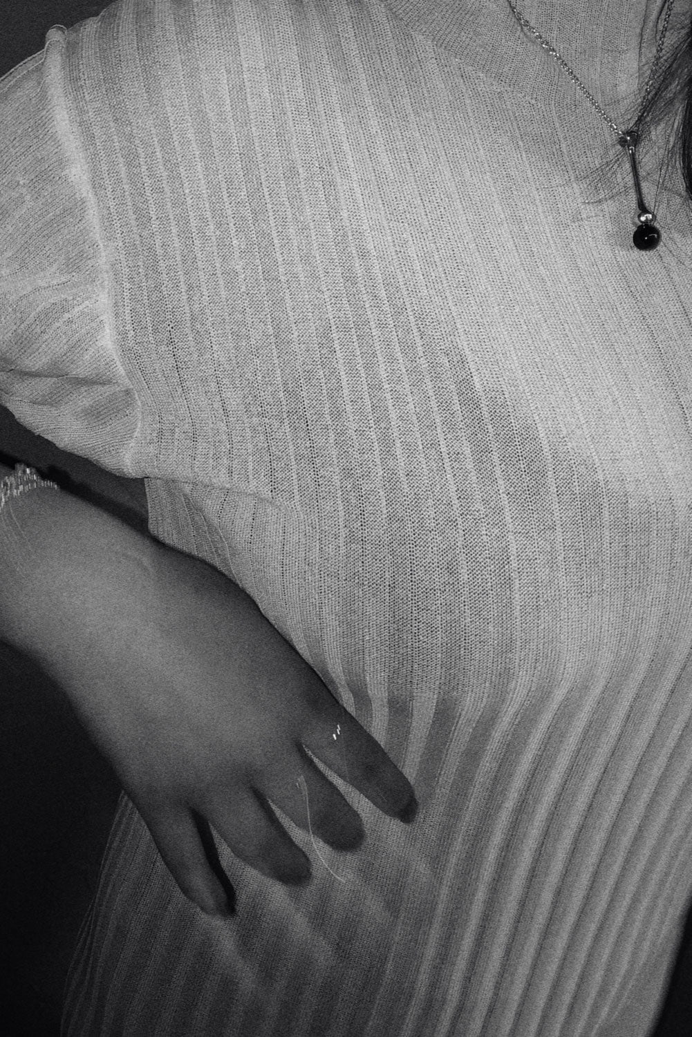 U.undulation long NC